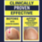 Clinically proven effective