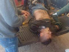 ITAPÚA: Policía y sospechoso heridos tras tiroteo en San Pedro del Paraná.