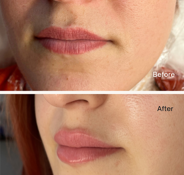 Beige Minimalist Skincare Before and After Instagram Post.png