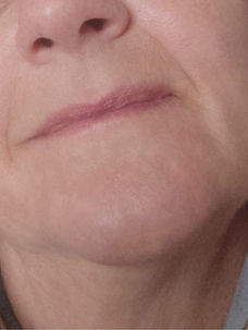 Fallstudie vorher / nachher