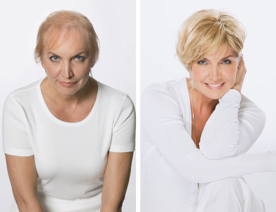 Haarverdichtung Looks by Rickert