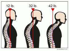 The Neck – The Master of Counterbalance.