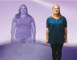 Bariatric Surgery in Dubai