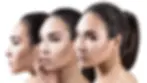 Plasma Pen bei Ramon Beauty Kosmetikstudio Wiesbaden – die Lösung für straffere Haut ohne invasive Eingriffe. Unsere sanften Behandlungen schenken Ihnen neue Frische und ein glattes Hautbild.