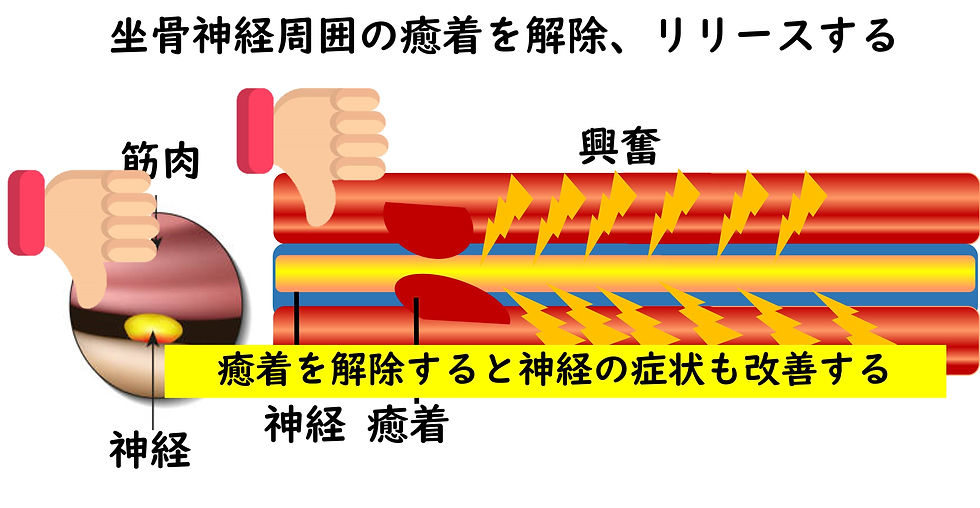 神経の滑走を促す手技の画像
