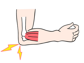 肘がズキズキ痛い…それ神経の圧迫かも？原因と治し方を解説！