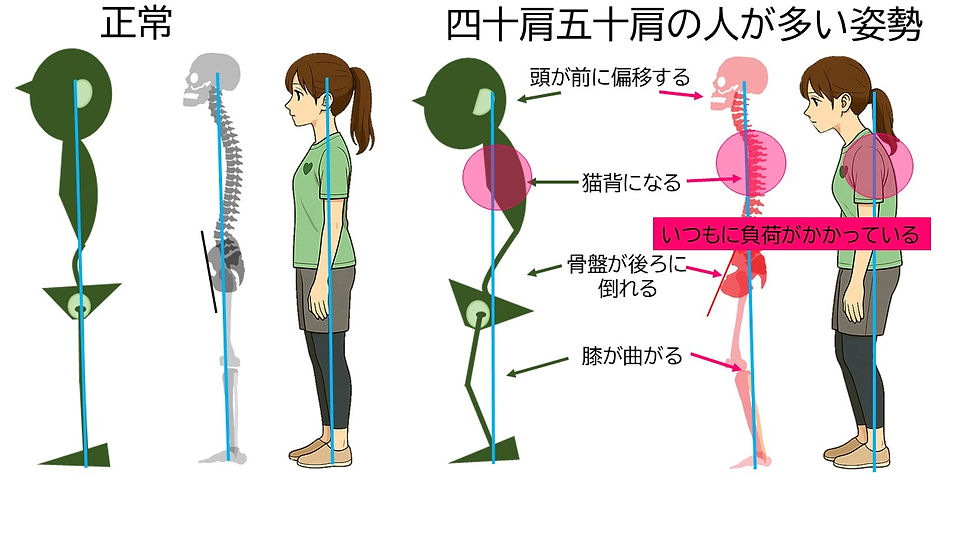 五十肩に多い姿勢