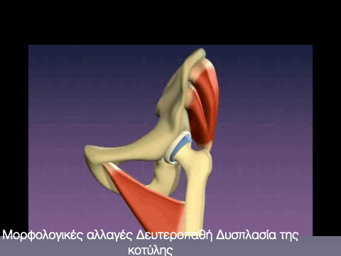 πορεια