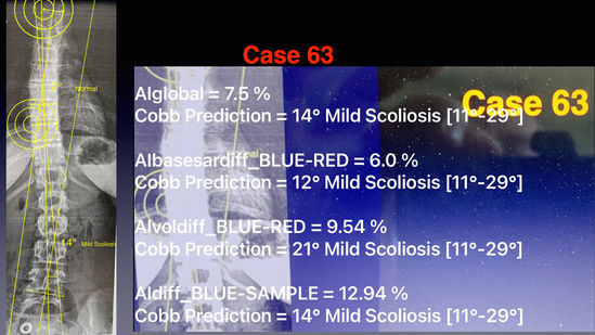 SCOLIOSIS WORIKING DEMO .063.jpeg