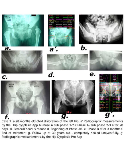 papadimitriou method case 1.jpeg