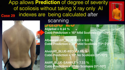SCOLIOSIS WORIKING DEMO .025.jpeg