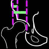 reimer index app measure orthopractis