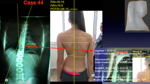 9 SCOLIOSIS WORIKING DEMO .060.jpeg