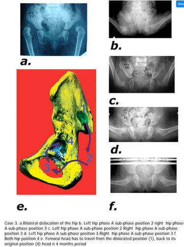 papadimitriou method case3ddh.jpeg