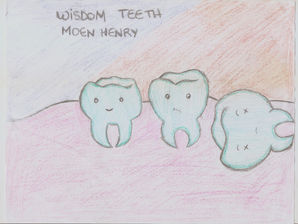 Wisdom Teeth: are they worth the pain?