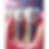 Cross-section illustration of dental implants showing the titanium post fused into the jawbone with a natural-looking crown on top