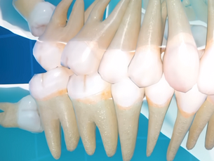 Common Misconceptions About Wisdom Teeth (Explained Simply)
