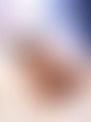 Teeth Grinding (Bruxism): When It’s Normal — and When It’s Not