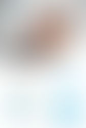 Cuidado con las caries