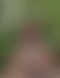 Uma conversa franca sobre os desafios de conviver com um transtorno mental