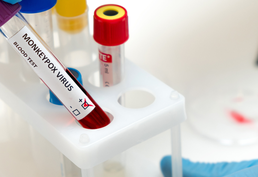 Ministério da Saúde lança Plano de Contingência Nacional para varíola dos macacos