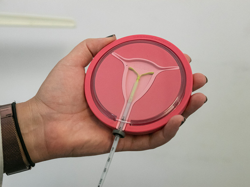 Macaé: Saúde disponibiliza DIU hormonal para endometriose e outras indicações