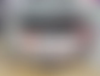 Mercedes Vito - Car Speakers upgraded to Rebec | Plug & Play Audio upgrade with Auto Edition Singapore