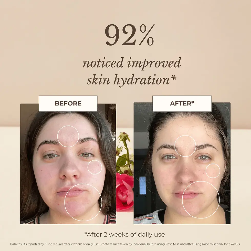 Thumbnail: Rose Essential Hydration Mist by Apoterra
