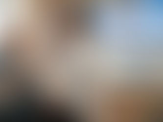 Clinic specialist demonstrates ear wax removal methods