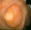 Q-1