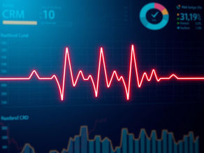 Continuous Revenue Intelligence: The Heartbeat of Better GTM Decisions