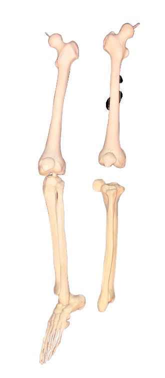 Thumbnail: Antique Anatomical Skeleton  Model including Human Lower Limb and Foot