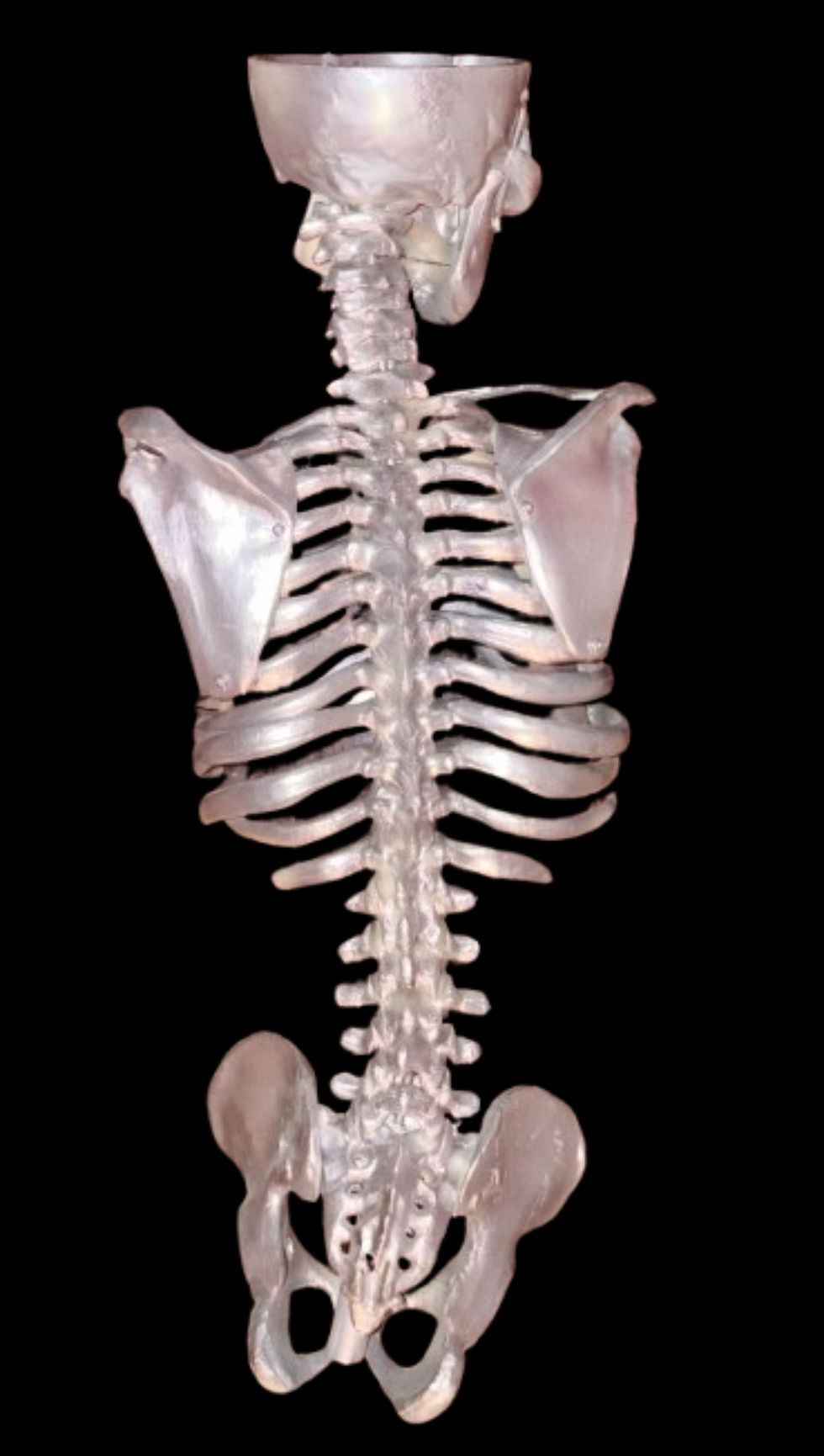 Thumbnail: Rare Anatomical Skeleton Model