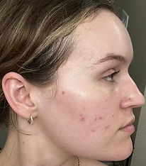 Right Facing.jpg