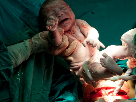 The highs and lows of caesarean sections.