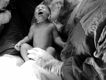 Caesarean Sections - The highs and lows