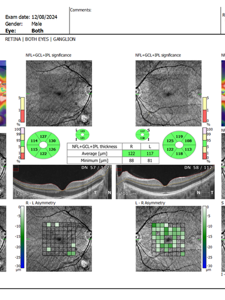 Exame para avaliação da saúde das células ganglionares e do nervo óptico.