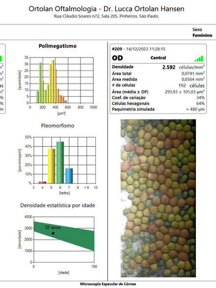 Microscopia Especular para avaliação das células da córnea
