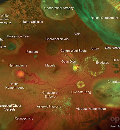 Atlas diagnóstico mostrando as diversas patologias que podem acometer a retina, e diagnosticadas por retinografia.