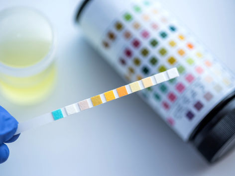 How Accurate Are The Urine Dipstick Tests For Diagnosing UTIs?