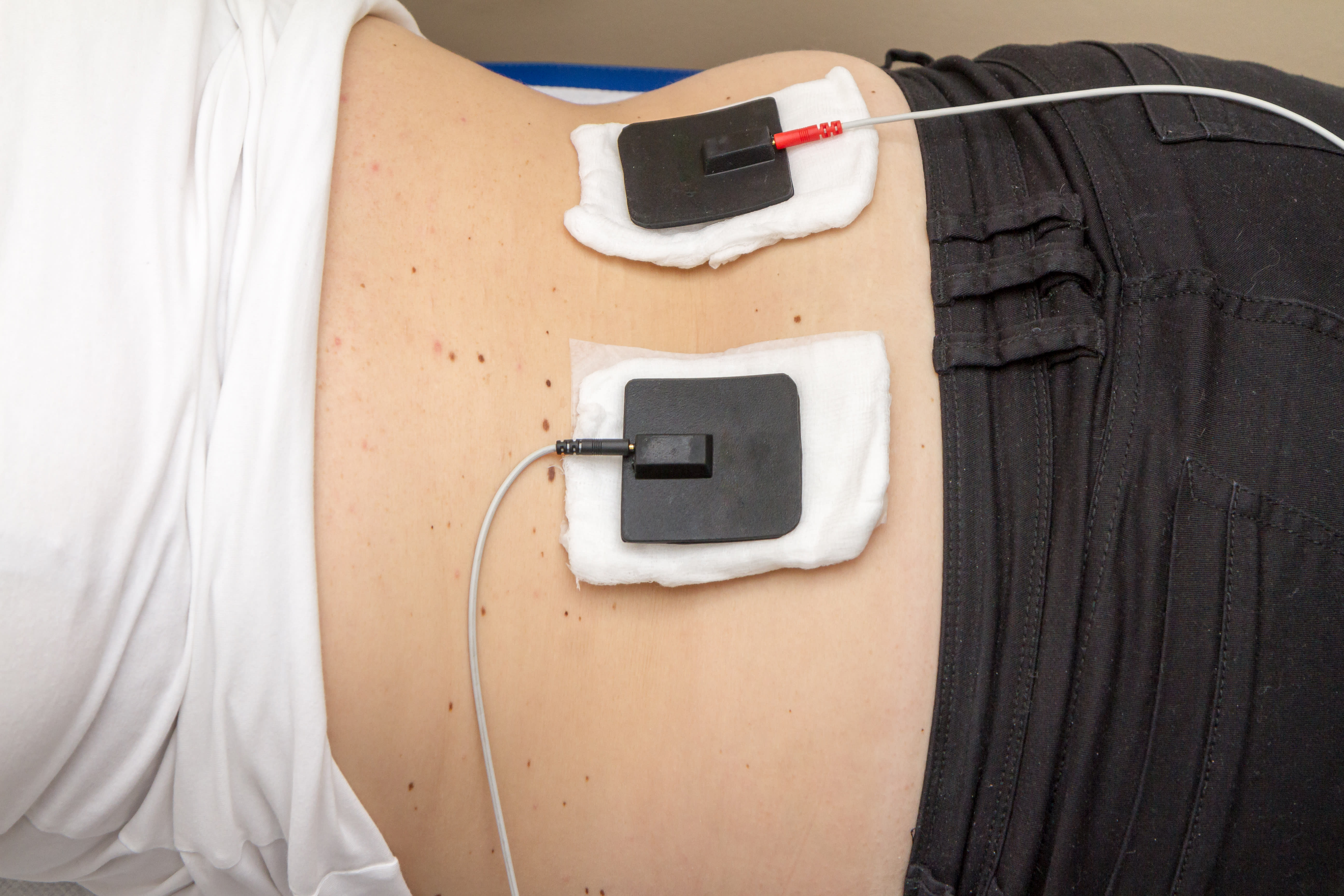 Best Wireless TENS Unit for Back Pain