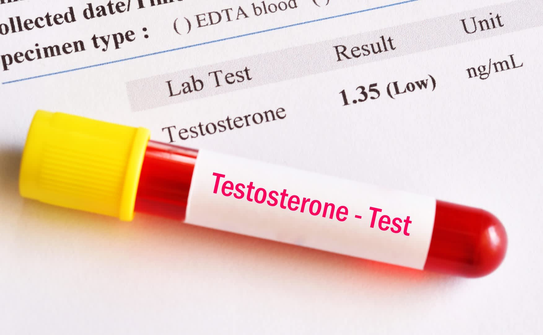 15 Benefits of Hormone Replacement Therapy for Men, Women & Aging People
