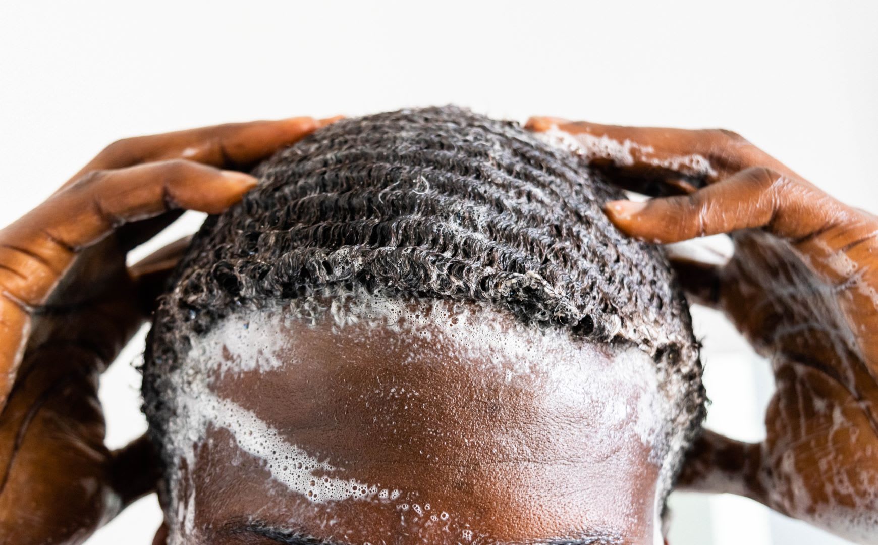 What Is The Best Dry Scalp Treatment For African American Hair?