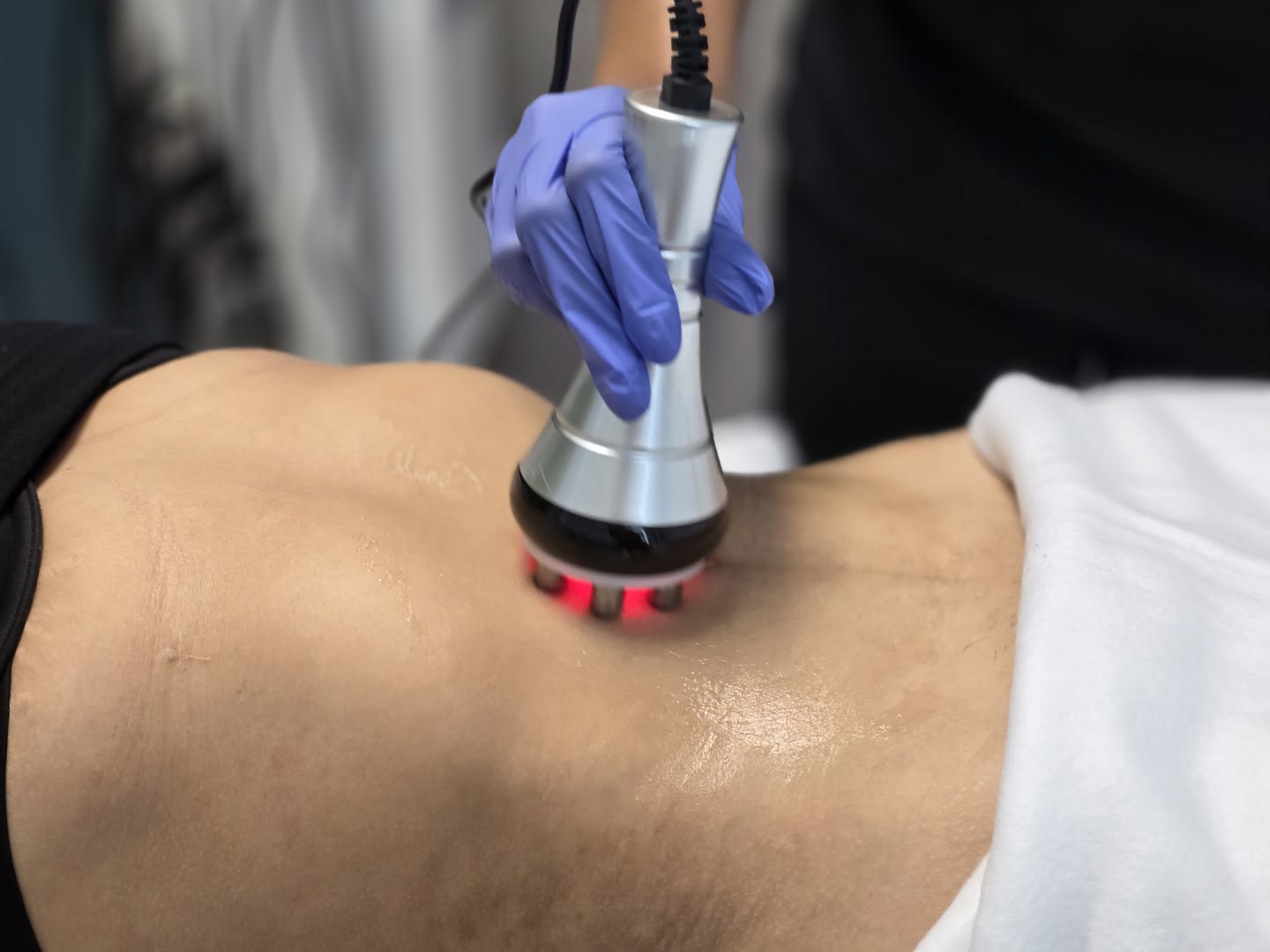 Why Choose Non-Invasive Body Contouring for Lasting Results?