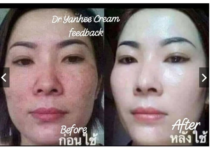 Thumbnail: Dr. Yanhee Anti-Aging Facial Set - Pink skin firming &Anti-aging