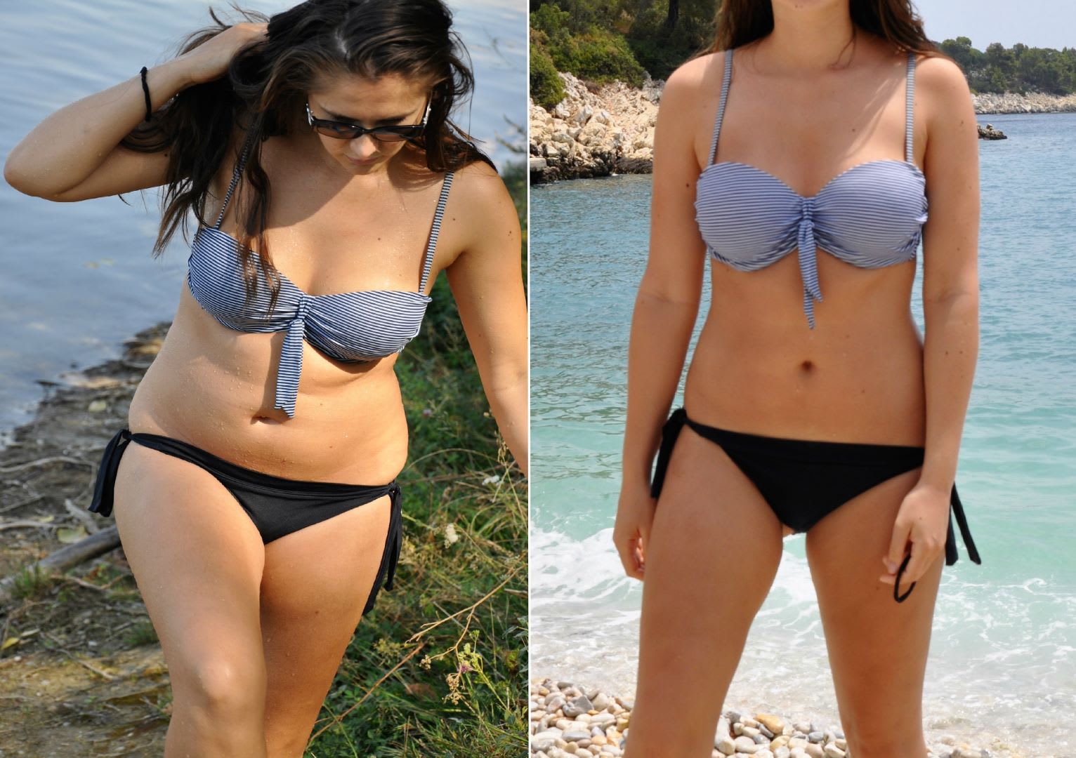 Tirzepatide-Mounjaro: Pioneering the Next Frontier in Obesity Treatment