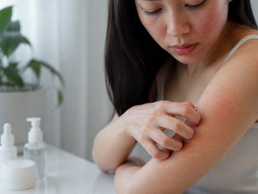 How to Soothe Itchy Sensitive Skin: A 2026 Guide