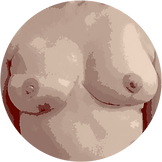 Reconstruction par DIEP