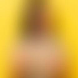 Prosopagnosia: entenda os desafios de quem convive com a cegueira facial