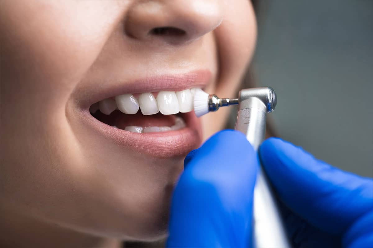 Preventive Dentistry